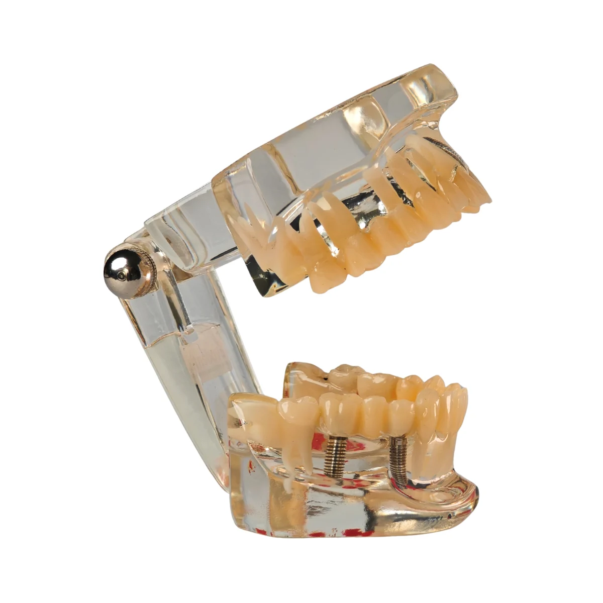 Evodent Signature All In One Model With Three Implant Fpd - Dental Implant Patient Education Model | Buy Now At Evodent Evodent signature all in one model with three implant fpd - dental implant patient education model