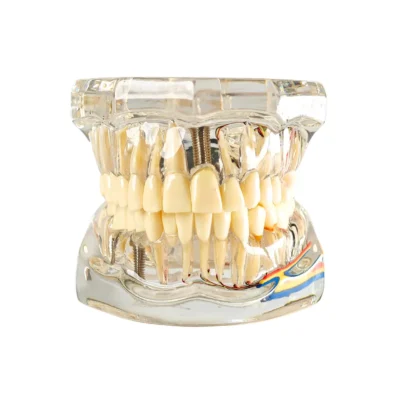 Evodent Signature All In One Model With Nerve Supply Clear Evodent signature all in one model with nerve supply clear