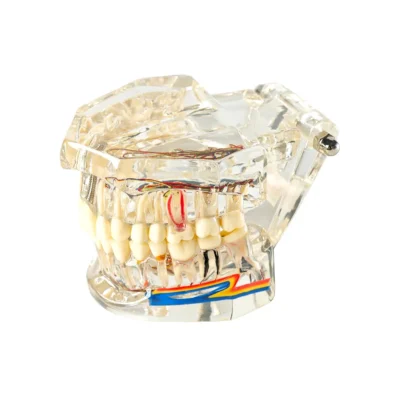 All In One Dental Models | Buy Now At Evodent Evodent signature all in one model with nerve supply clear