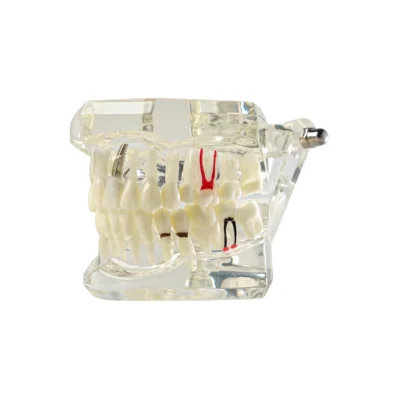 All In One Dental Models | Buy Now At Evodent Evodent signature all in one with three implant