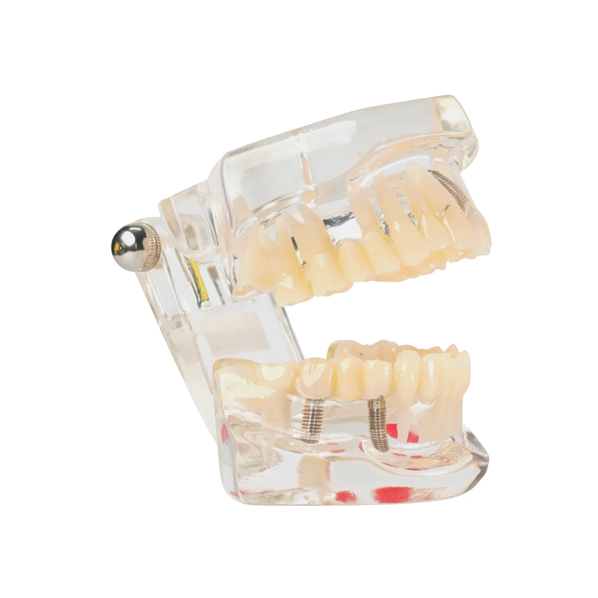 Evodent Signature All In One Model With Three Implant Fpd - Dental Implant Patient Education Model | Buy Now At Evodent Evodent signature all in one model with three implant fpd - dental implant patient education model