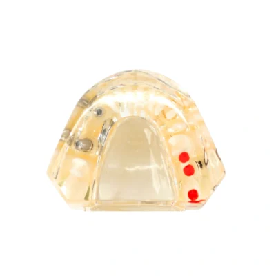 Evodent Signature All In One Model With Three Implant Fpd – Dental Implant Patient Education Model Evodent signature all in one model with three implant fpd - dental implant patient education model