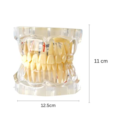 Evodent Signature Enlarged All In One Transparent Dental Anatomy And Pathology Model Evodent signature enlarged all in one transparent dental anatomy and pathology model