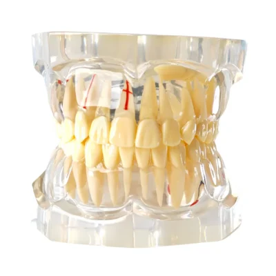 All In One Dental Models | Buy Now At Evodent Evodent signature enlarged all in one transparent dental anatomy and pathology model
