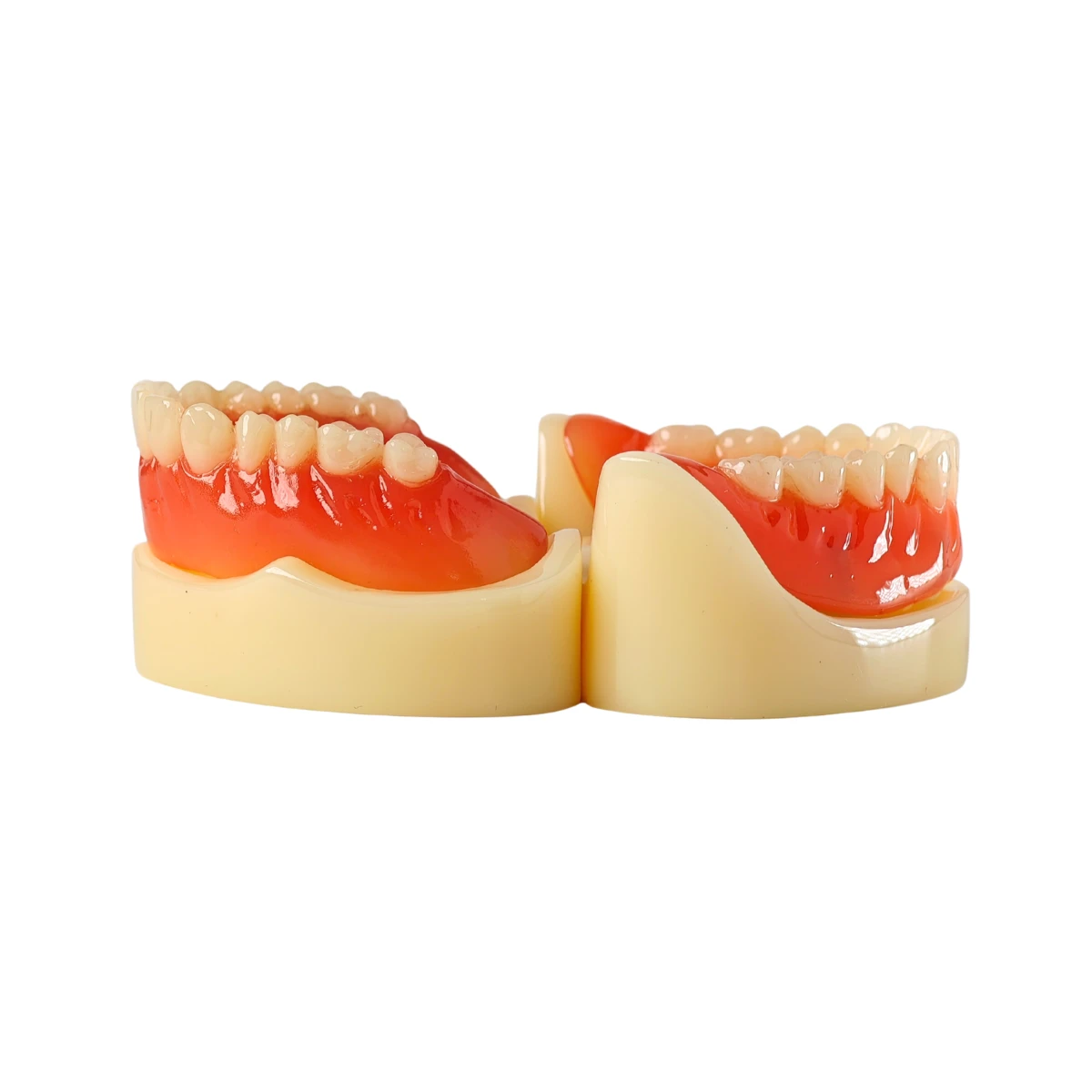 Evodent Full Denture With Implant Model For Patient Education | Buy Now At Evodent Evodent signature full denture with implant model for patient education
