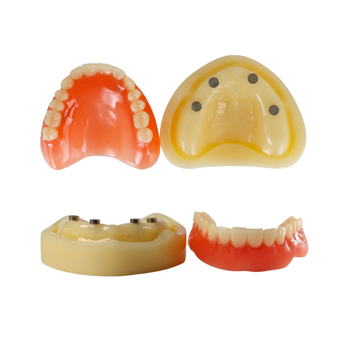 Evodent Full Denture With Implant Model For Patient Education | Buy Now At Evodent Evodent signature full denture with implant model for patient education