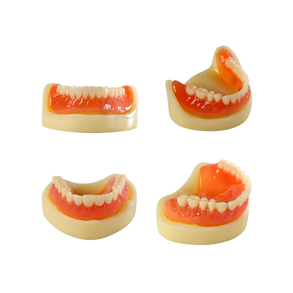 Evodent Full Denture With Implant Model For Patient Education | Buy Now At Evodent Evodent signature full denture with implant model for patient education