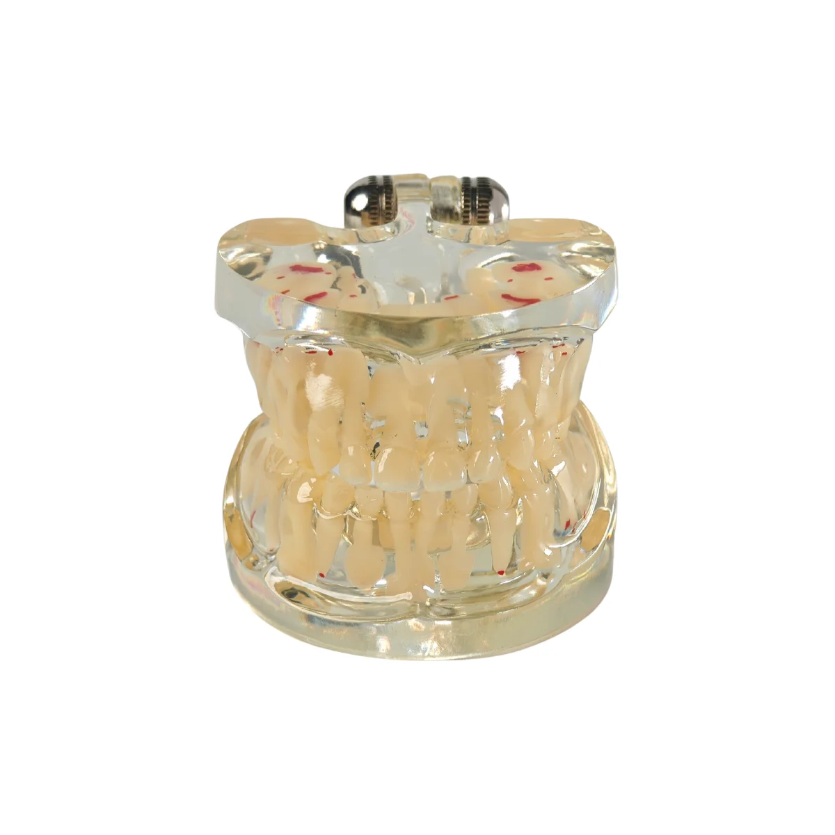 Evodent Signature Mixed Dentition Model Without Caries Clear | Buy Now At Evodent Evodent signature mixed dentition model without caries clear