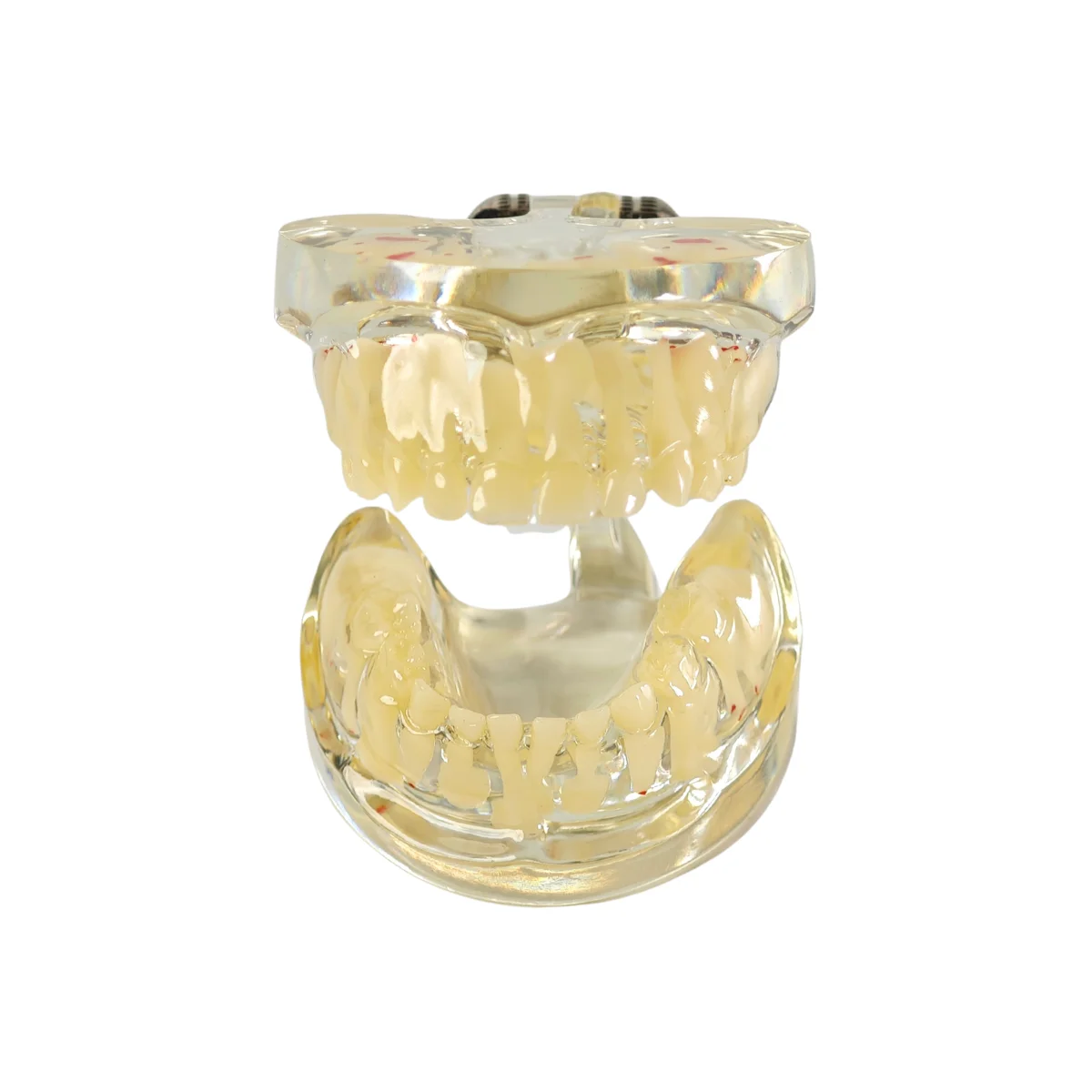 Evodent Signature Mixed Dentition Model Without Caries Clear | Buy Now At Evodent Evodent signature mixed dentition model without caries clear