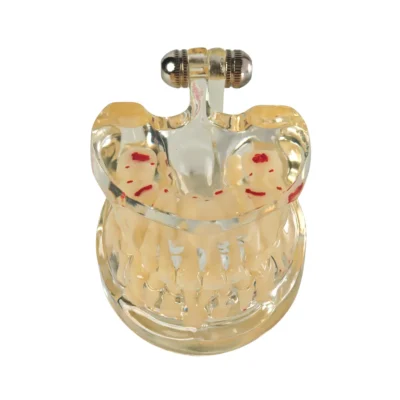 Evodent Signature Mixed Dentition Model without Caries Clear Evodent Signature Mixed Dentition Model without Caries Clear