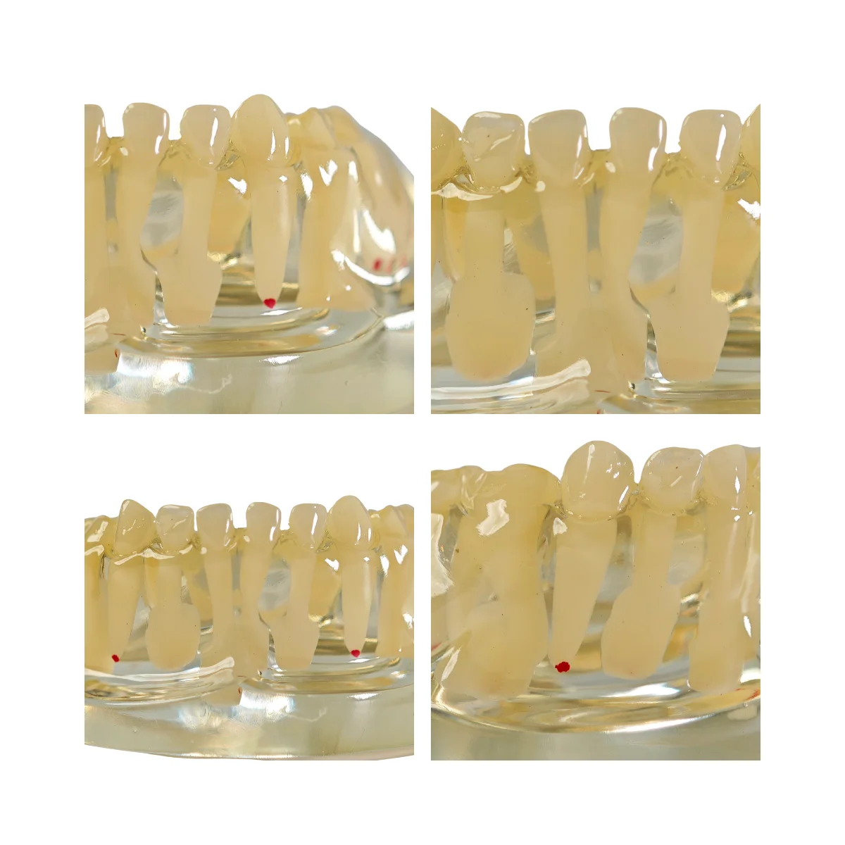 Evodent Signature Mixed Dentition Model Without Caries Clear | Buy Now At Evodent Evodent signature mixed dentition model without caries clear