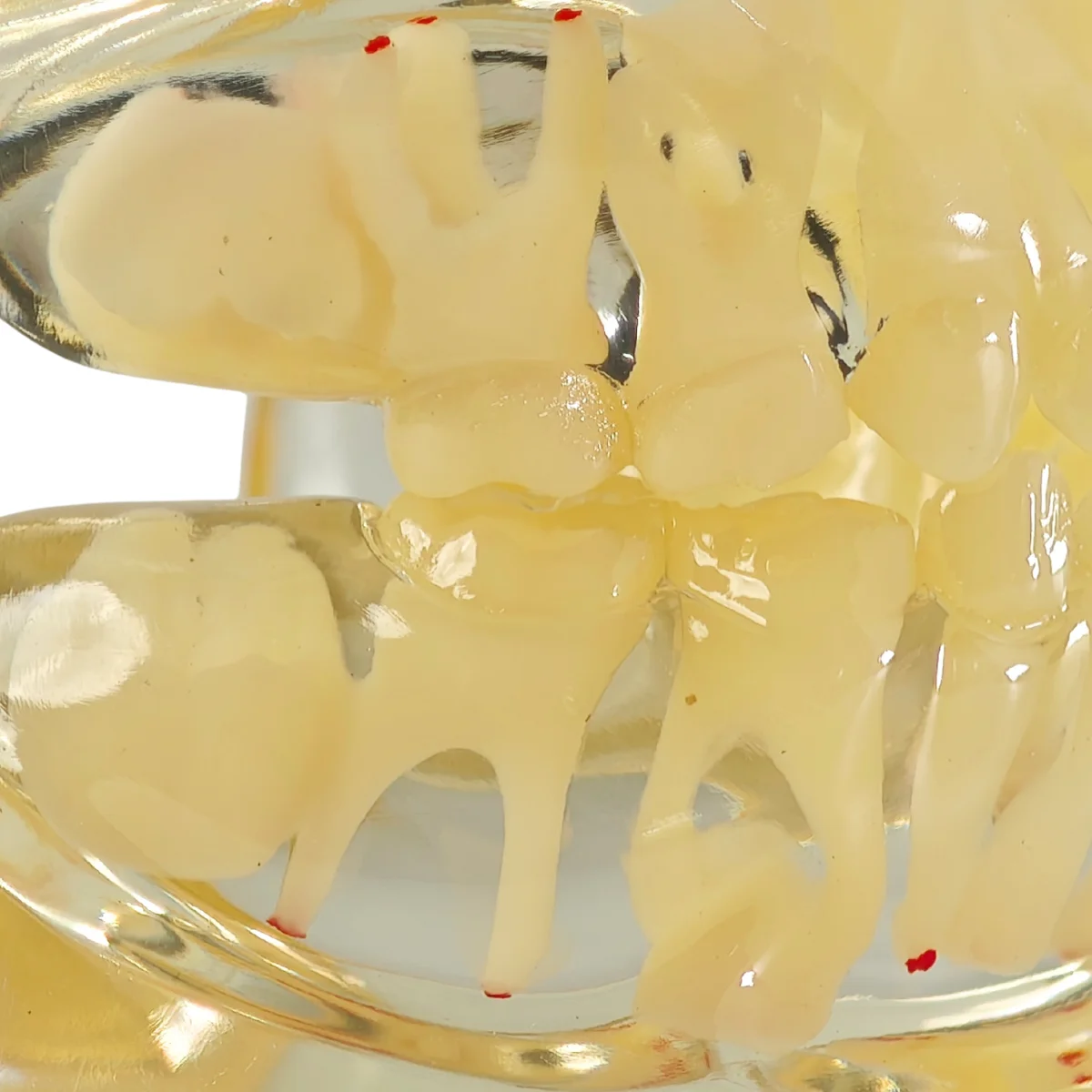 Evodent Signature Mixed Dentition Model Without Caries Clear | Buy Now At Evodent Evodent signature mixed dentition model without caries clear