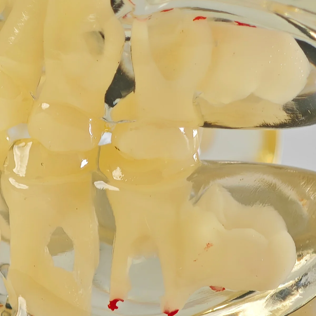 Evodent Signature Mixed Dentition Model Without Caries Clear | Buy Now At Evodent Evodent signature mixed dentition model without caries clear