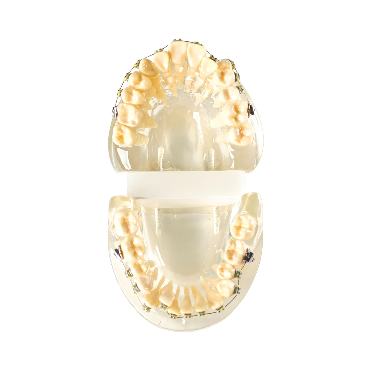 Evodent Signature Dental Malocculation Model With Metal Bracket, Patient Education Model | Buy Now At Evodent Eevodent signature dental malocculation model with metal bracket, patient education model