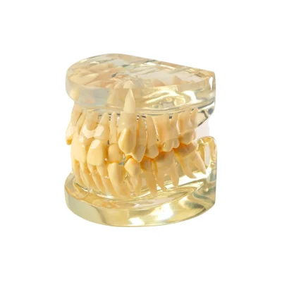 Evodent Orthodontic Model Class I Malocclusion Clear