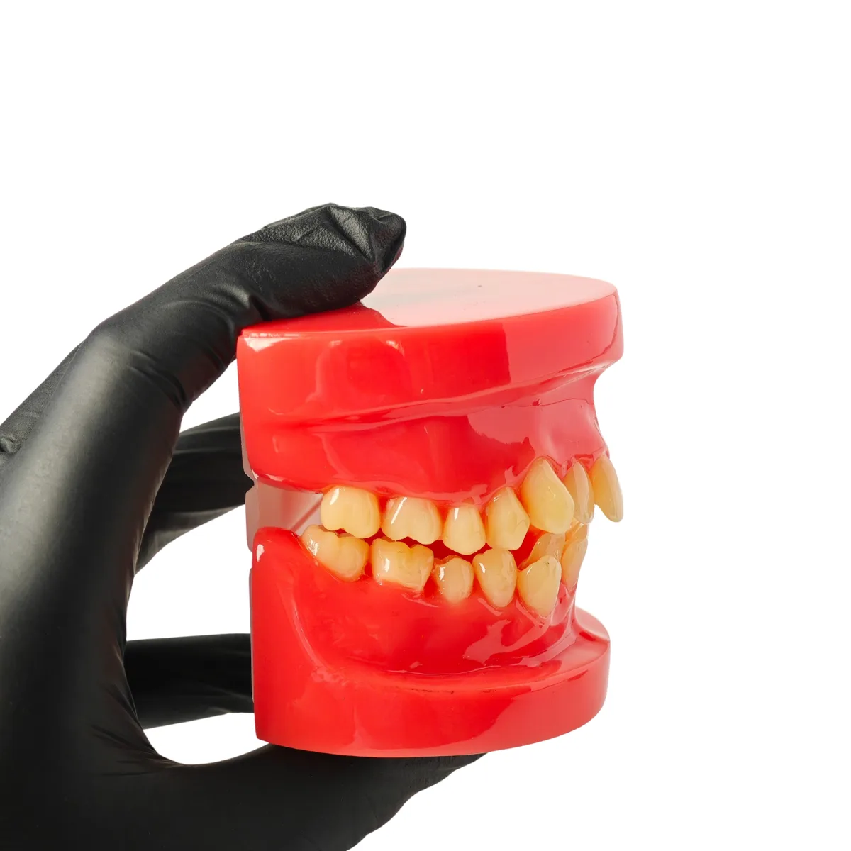 Evodent Class I Malocclusion Orthodontic Dental Model - Occlusion And Alignment Demonstration, Pink | Buy Now At Evodent Evodent orthodontic model class i malocclusion pink