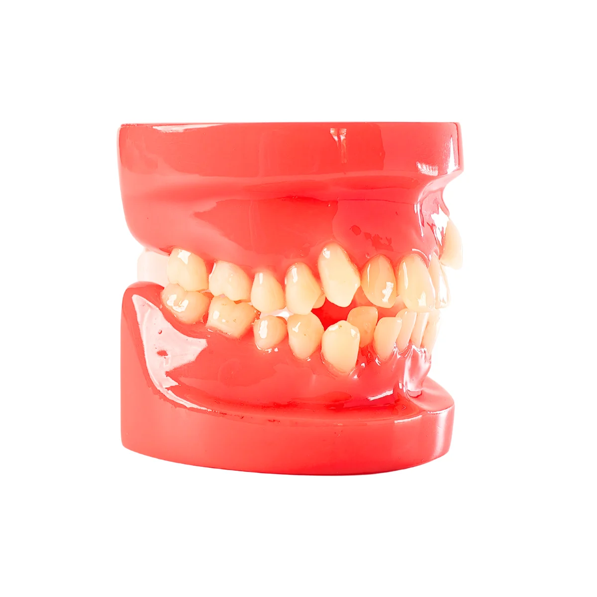 Evodent Class I Malocclusion Orthodontic Dental Model - Occlusion And Alignment Demonstration, Pink | Buy Now At Evodent Evodent orthodontic model class i malocclusion pink