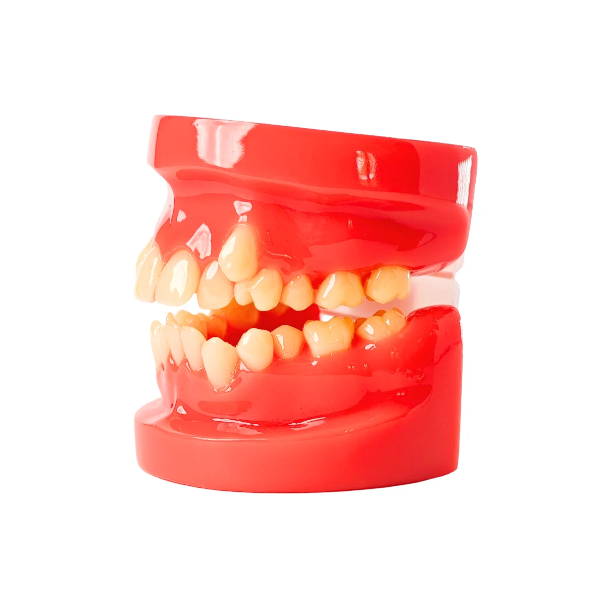Evodent Class I Malocclusion Orthodontic Dental Model - Occlusion And Alignment Demonstration, Pink | Buy Now At Evodent Evodent orthodontic model class i malocclusion pink