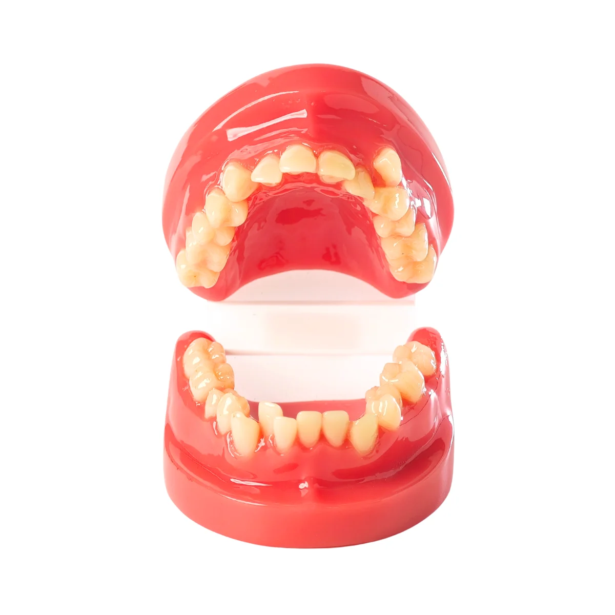 Evodent Class I Malocclusion Orthodontic Dental Model - Occlusion And Alignment Demonstration, Pink | Buy Now At Evodent Evodent orthodontic model class i malocclusion pink