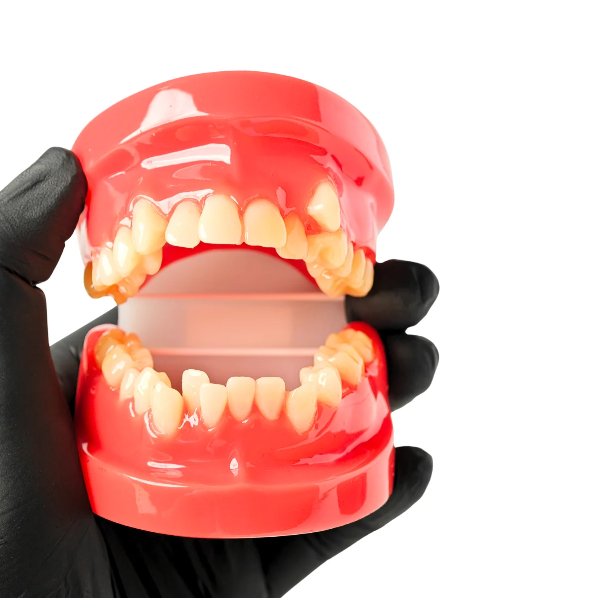 Evodent Class I Malocclusion Orthodontic Dental Model - Occlusion And Alignment Demonstration, Pink | Buy Now At Evodent Evodent orthodontic model class i malocclusion pink