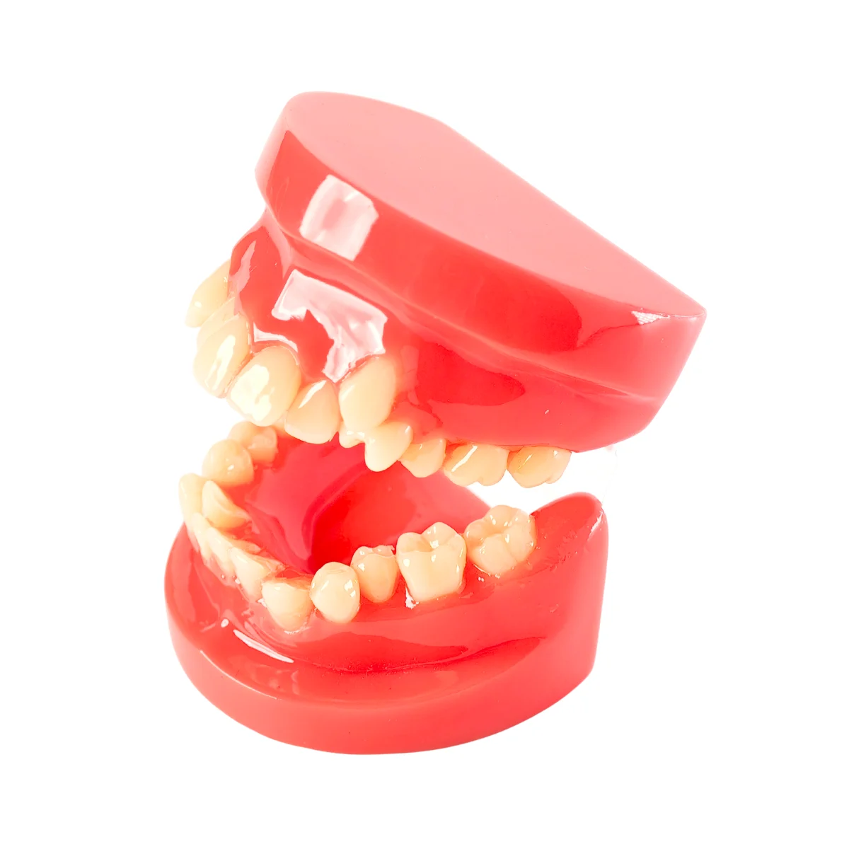 Evodent Class I Malocclusion Orthodontic Dental Model - Occlusion And Alignment Demonstration, Pink | Buy Now At Evodent Evodent orthodontic model class i malocclusion pink
