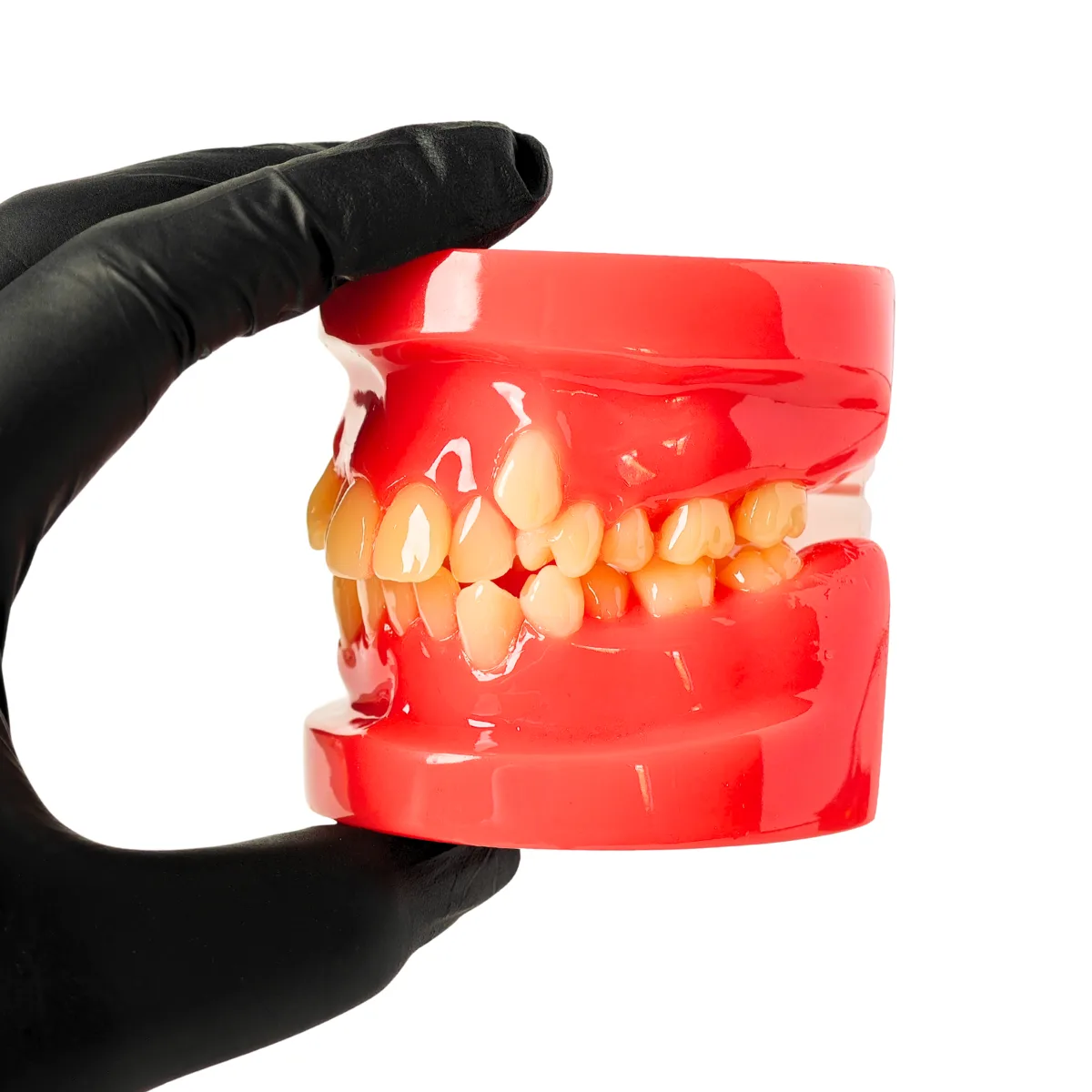 Evodent Class I Malocclusion Orthodontic Dental Model - Occlusion And Alignment Demonstration, Pink | Buy Now At Evodent Evodent orthodontic model class i malocclusion pink