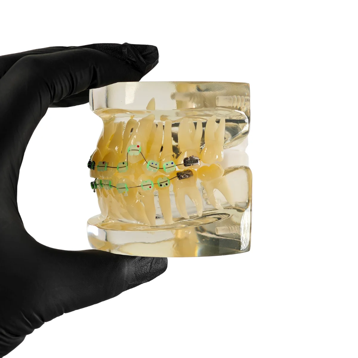 Evodent Signature Orthodontic Model Half Metal &Amp; Half Ceramic Bracket | Buy Now At Evodent Evodent signature orthodontic model half metal & half ceramic bracket