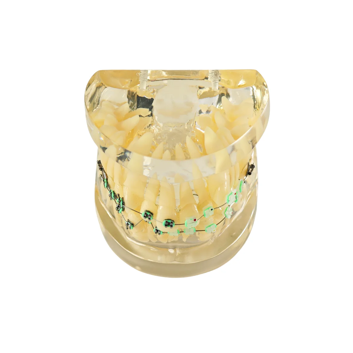 Evodent Signature Orthodontic Model Half Metal &Amp; Half Ceramic Bracket | Buy Now At Evodent Evodent signature orthodontic model half metal & half ceramic bracket