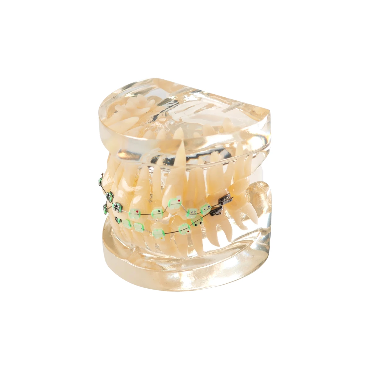 Evodent Signature Orthodontic Model Half Metal &Amp; Half Ceramic Bracket | Buy Now At Evodent Evodent signature dental malocculation model with metal bracket, patient education model
