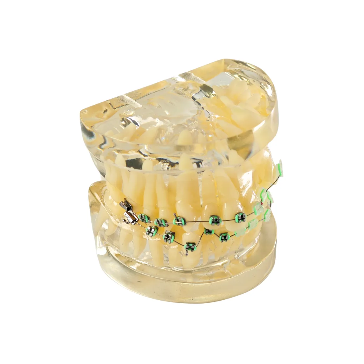 Evodent Signature Orthodontic Model Half Metal &Amp; Half Ceramic Bracket | Buy Now At Evodent Evodent signature orthodontic model half metal & half ceramic bracket