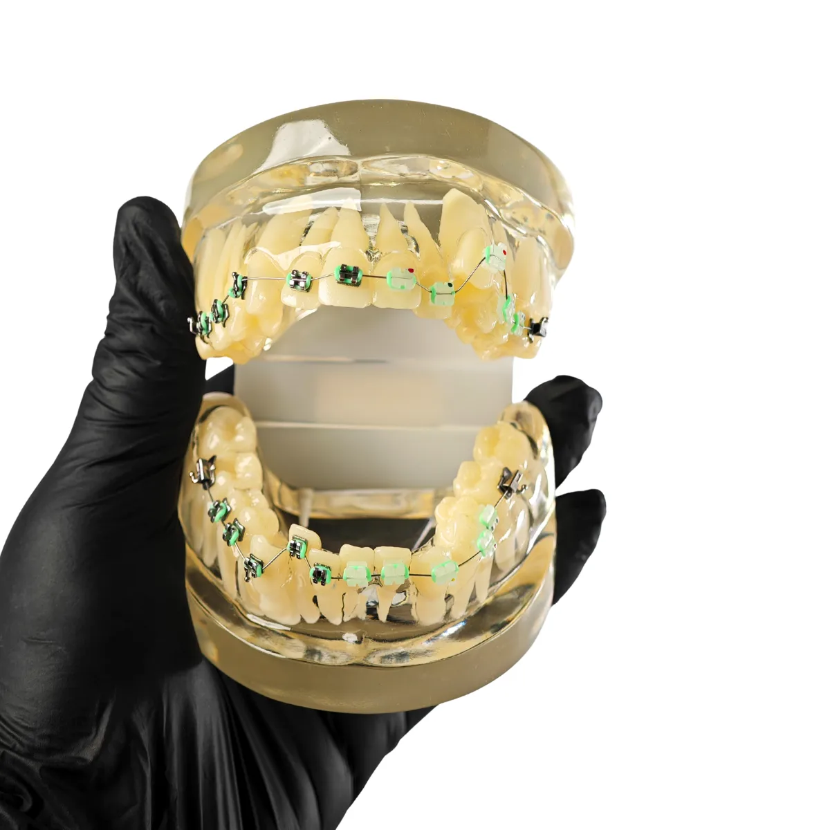 Evodent Signature Orthodontic Model Half Metal &Amp; Half Ceramic Bracket | Buy Now At Evodent Evodent signature orthodontic model half metal & half ceramic bracket