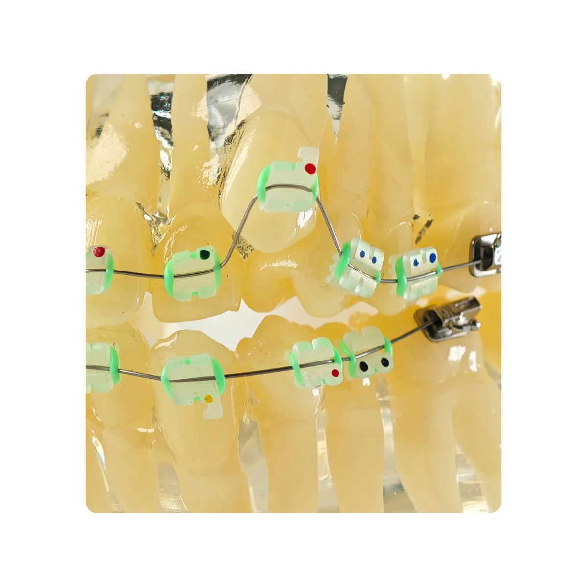 Evodent Signature Orthodontic Model Half Metal &Amp; Half Ceramic Bracket | Buy Now At Evodent Evodent signature orthodontic model half metal & half ceramic bracket