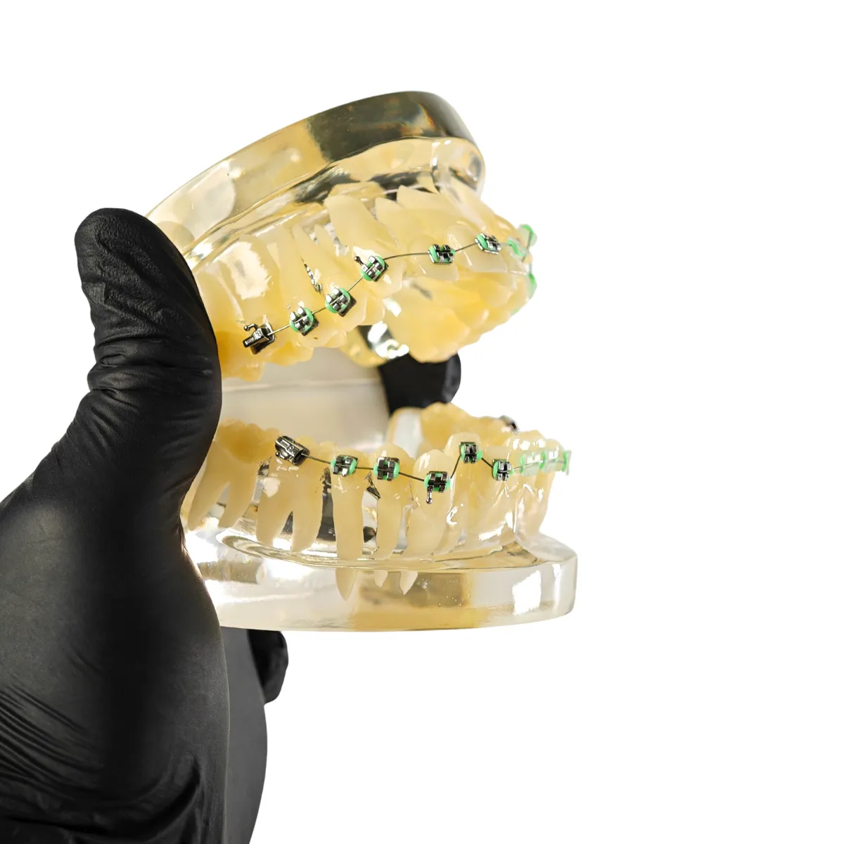 Evodent Signature Orthodontic Model Half Metal &Amp; Half Ceramic Bracket | Buy Now At Evodent Evodent signature orthodontic model half metal & half ceramic bracket