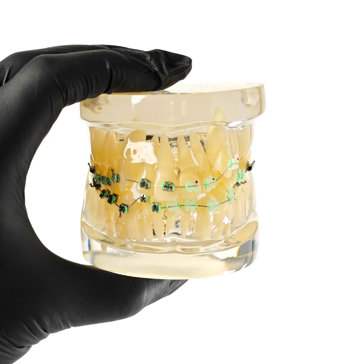 Evodent Signature Orthodontic Model Half Metal &Amp; Half Ceramic Bracket | Buy Now At Evodent Evodent signature orthodontic model half metal & half ceramic bracket