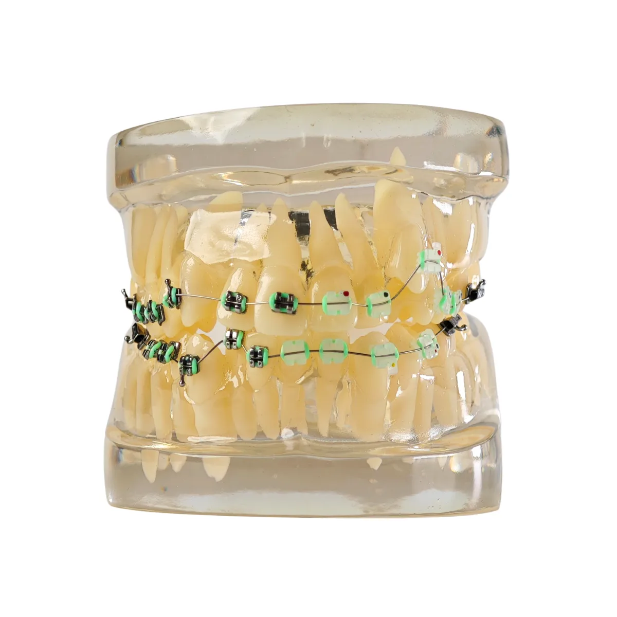 Evodent Signature Orthodontic Model Half Metal &Amp; Half Ceramic Bracket | Buy Now At Evodent Evodent signature orthodontic model half metal & half ceramic bracket