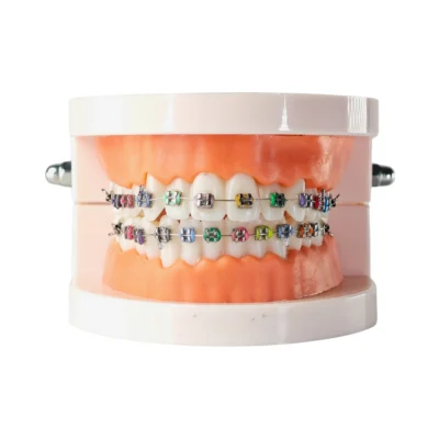 Home | Buy Now At Evodent Evodent orthodontic model with metal braces with colorful ligatures, patient education typodont