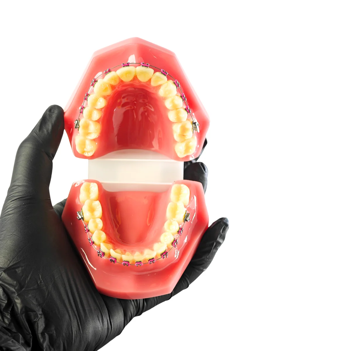 Evodent Orthodontic Model With Metal Braces And Pink Ligatures - Dental Braces Patient Education Model | Buy Now At Evodent Evodent orthodontic model with metal braces and pink ligatures - dental braces patient education model