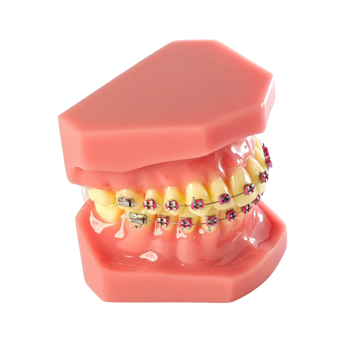 Evodent Orthodontic Model With Metal Braces And Pink Ligatures - Dental Braces Patient Education Model | Buy Now At Evodent Evodent orthodontic model with metal braces and pink ligatures - dental braces patient education model