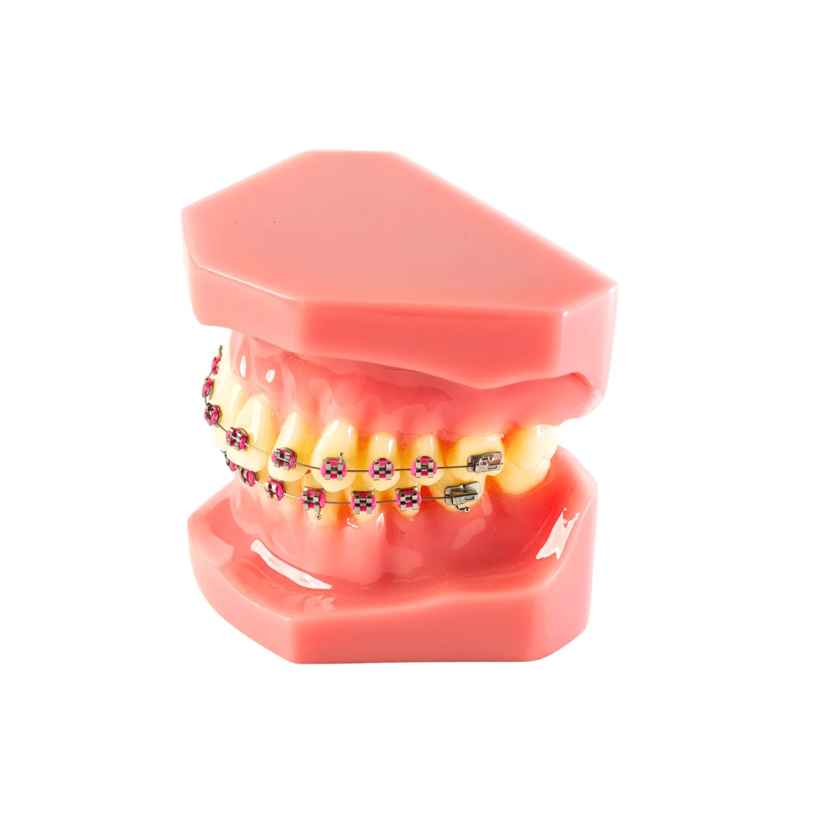 Evodent Orthodontic Model With Metal Braces And Pink Ligatures - Dental Braces Patient Education Model | Buy Now At Evodent Evodent orthodontic model with metal braces and pink ligatures - dental braces patient education model