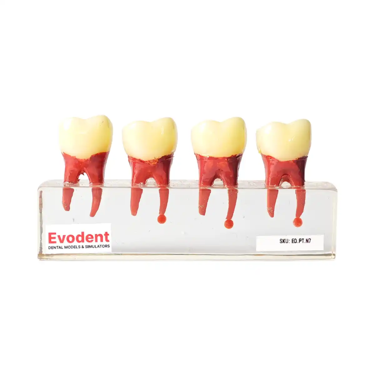 Evodent Root Canal Treatment Rct Stages Model - Caries, Pulp Exposure, Endodontic Filling And Post Core Demonstration | Buy Now At Evodent Evodent root canal treatment rct stages model - caries, pulp exposure, endodontic filling and post core demonstration