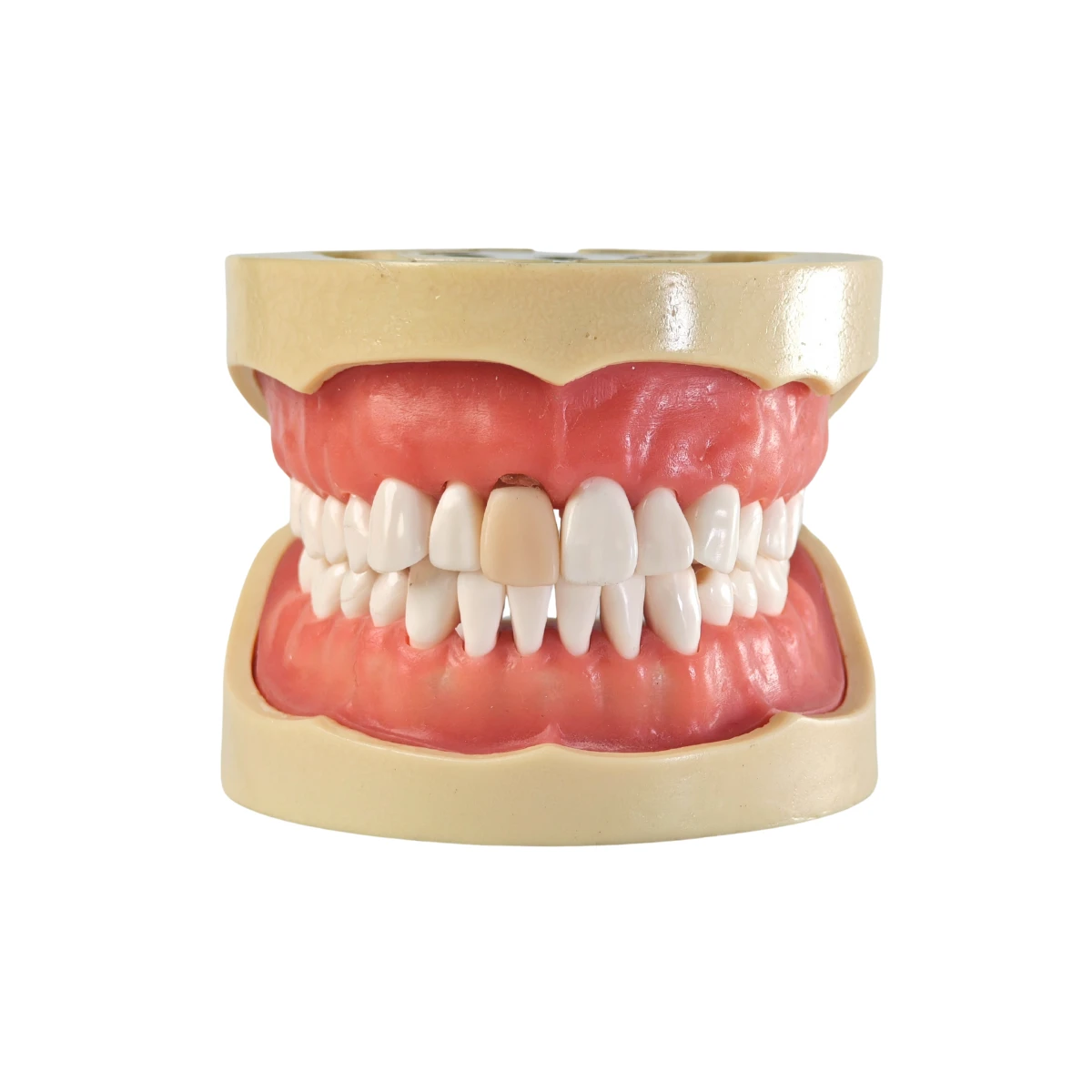 Evodent Signature Root Canal Model With Jaw And Removable Tooth | Buy Now At Evodent Evodent signature root canal model with jaw and removable tooth
