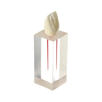 Evodent Root Canal Training Block with Crown, Endodontic Tooth Model – 14, 21, 26, Clear Resin Canal Anatomy for RCT Practice Evodent Root Canal Training Block with Crown, Endodontic Tooth Model - 14, 21, 26, Clear Resin Canal Anatomy for RCT Practice