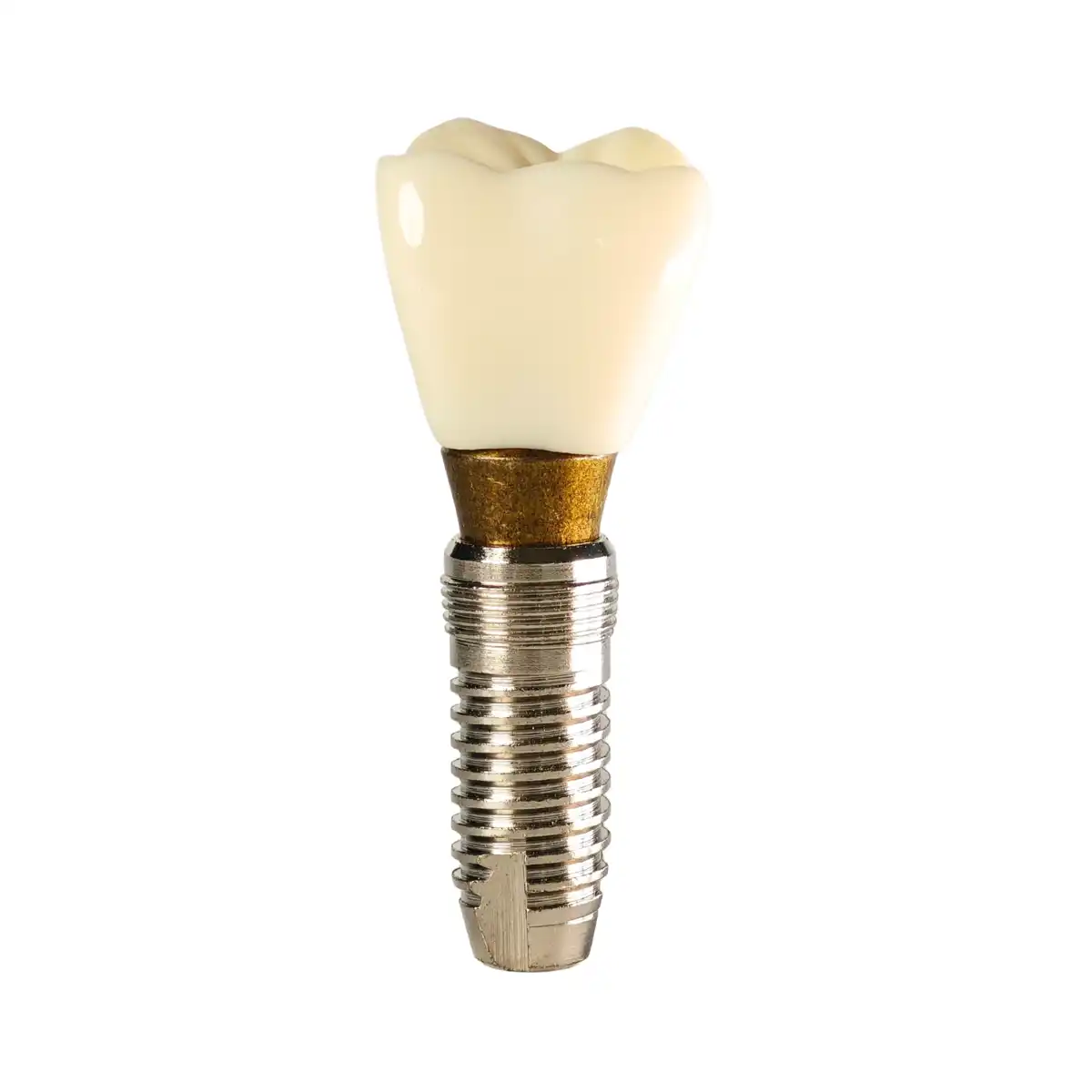 Evodent Three Part Implant Model With Clear Base | Buy Now At Evodent Evodent three part implant model with clear base