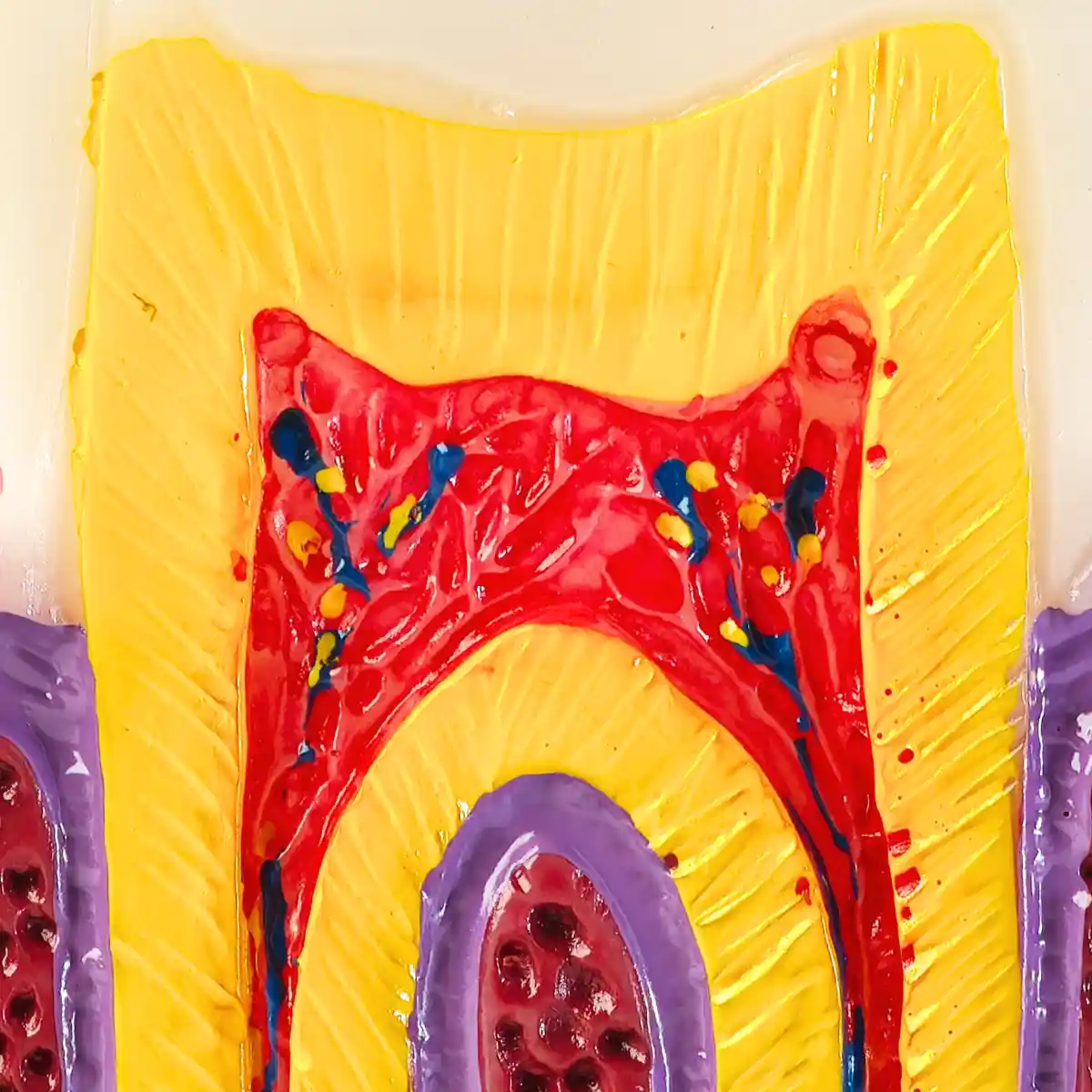 Evodent Advanced Tooth Decay Cross Section Model - Caries Progression, Pulp &Amp; Root Canal Anatomy | Buy Now At Evodent Evodent advanced tooth decay cross section model - caries progression, pulp & root canal anatomy