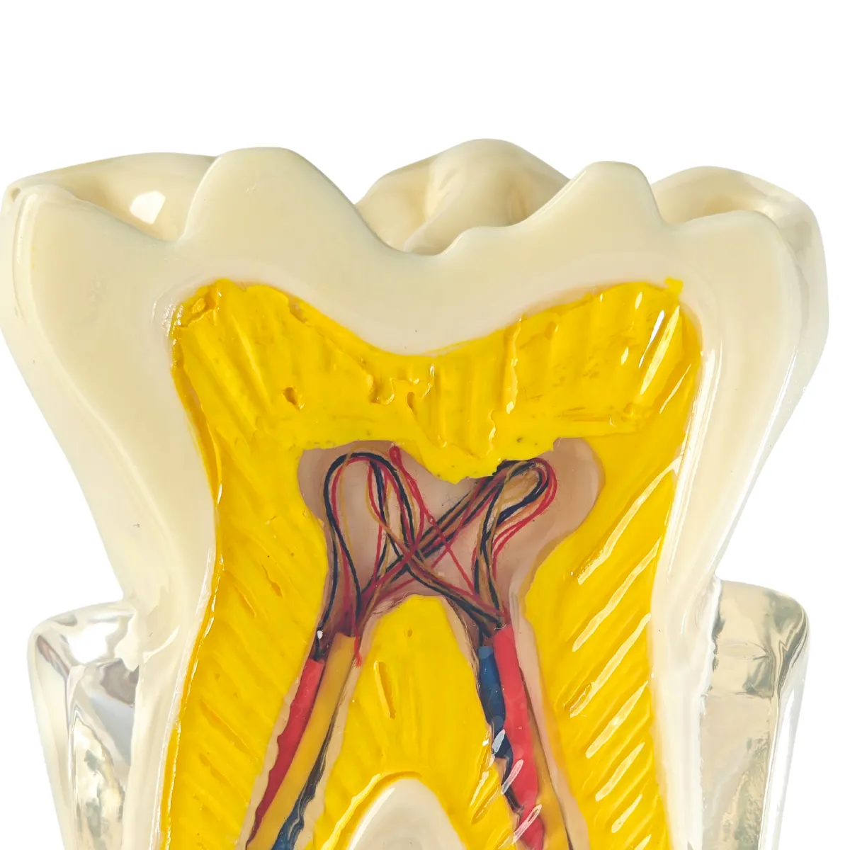 Evodent Tooth Anatomy Cross-Section Model With Pulp And Nerve Supply For Patient Education | Buy Now At Evodent Evodent tooth anatomy cross-section model with pulp and nerve supply for patient education