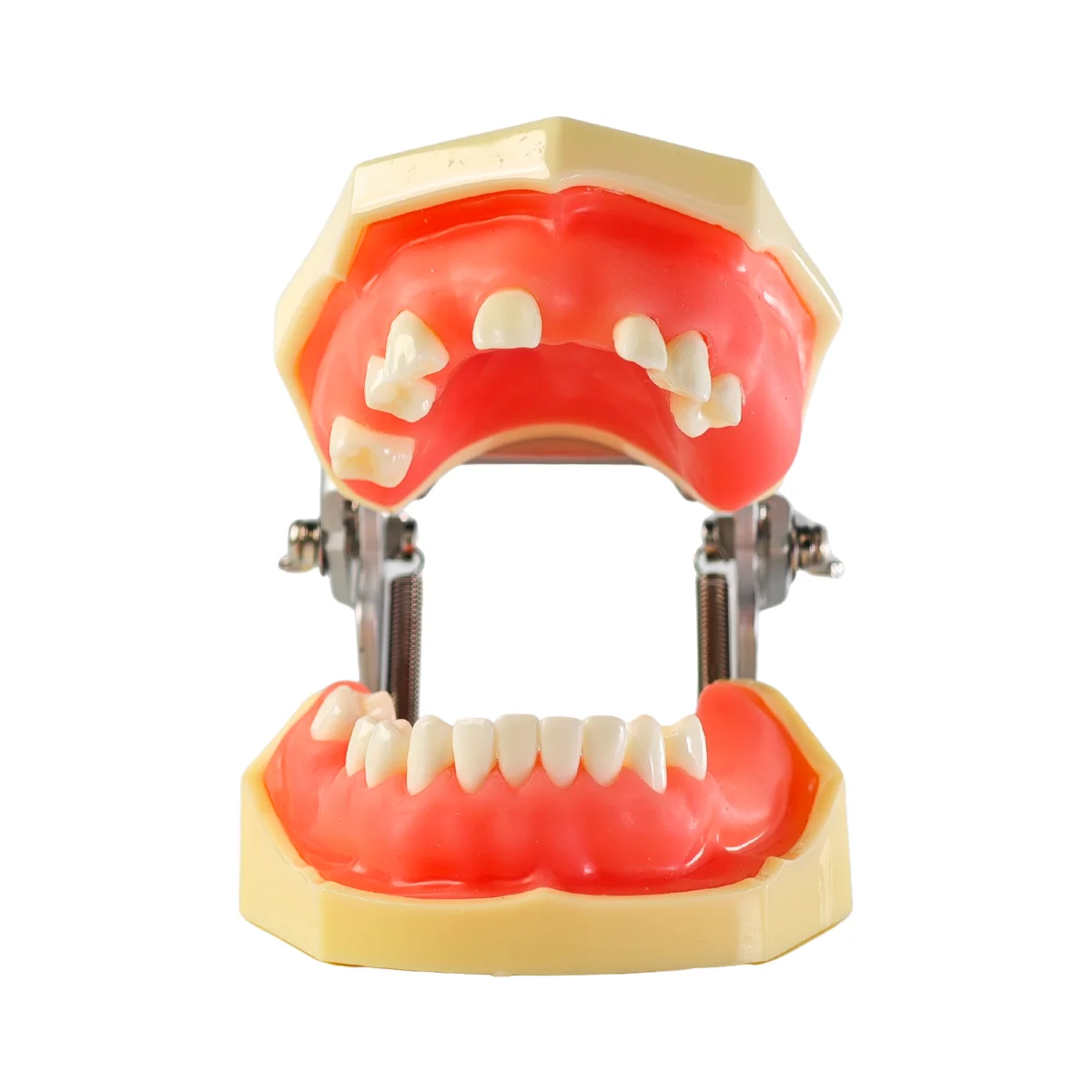 Evodent Sinus Lift Demonstration Model - Dental Implant Practice And Sinus Augmentation Training Model | Buy Now At Evodent Evodent sinus lift demonstration model - dental implant practice and sinus augmentation training model