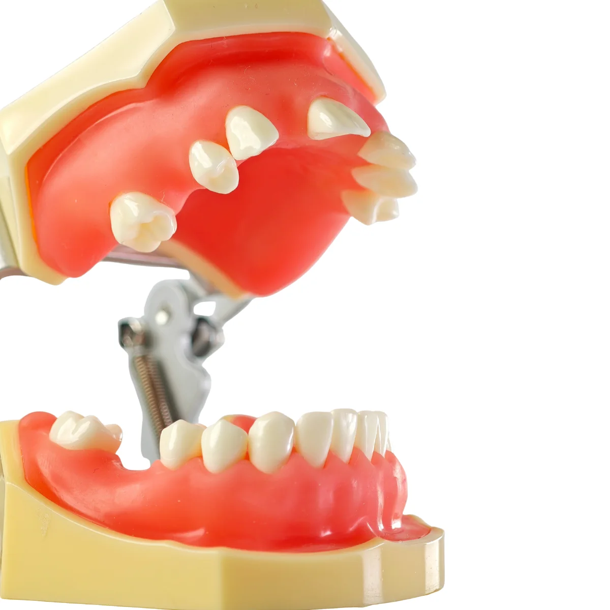 Evodent Sinus Lift Demonstration Model - Dental Implant Practice And Sinus Augmentation Training Model | Buy Now At Evodent Evodent sinus lift demonstration model - dental implant practice and sinus augmentation training model