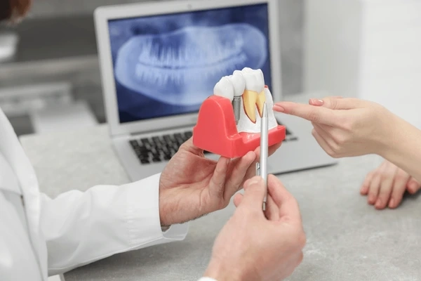 Home | Buy Now At Evodent Dental model used in a dental clinic for patient education