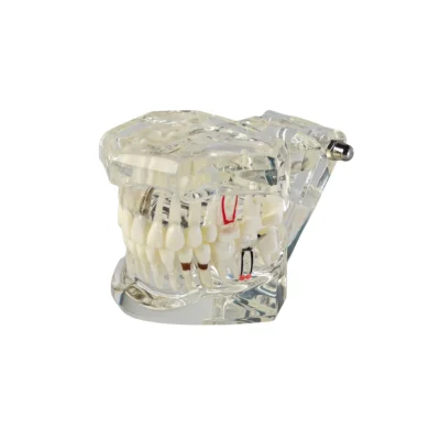 Home | Buy Now At Evodent Evodent signature all in one with pathology and implant clear all in one dental scan displaying detailed tooth structures with clear visibility of pathology image also highlights implant placement with high-resolution clarity