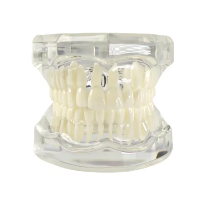 Evodent Ideal Dental Model for Patient Education